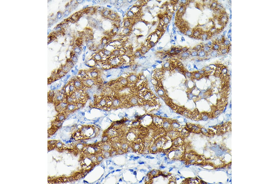 Immunohistochemistry - Anti-MNK1 Antibody (A309108) - Antibodies.com