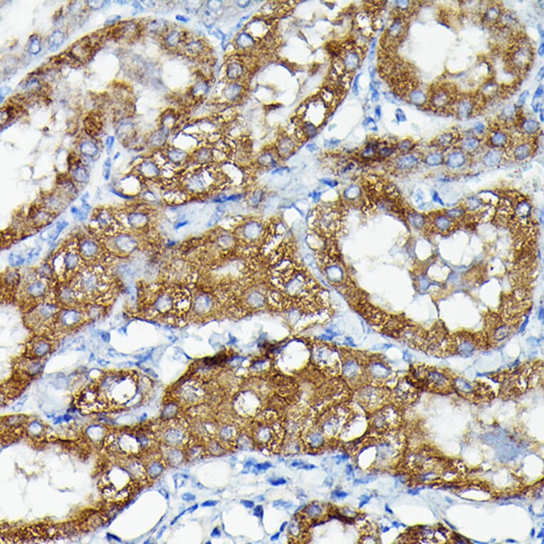 Immunohistochemistry - Anti-MNK1 Antibody (A309108) - Antibodies.com