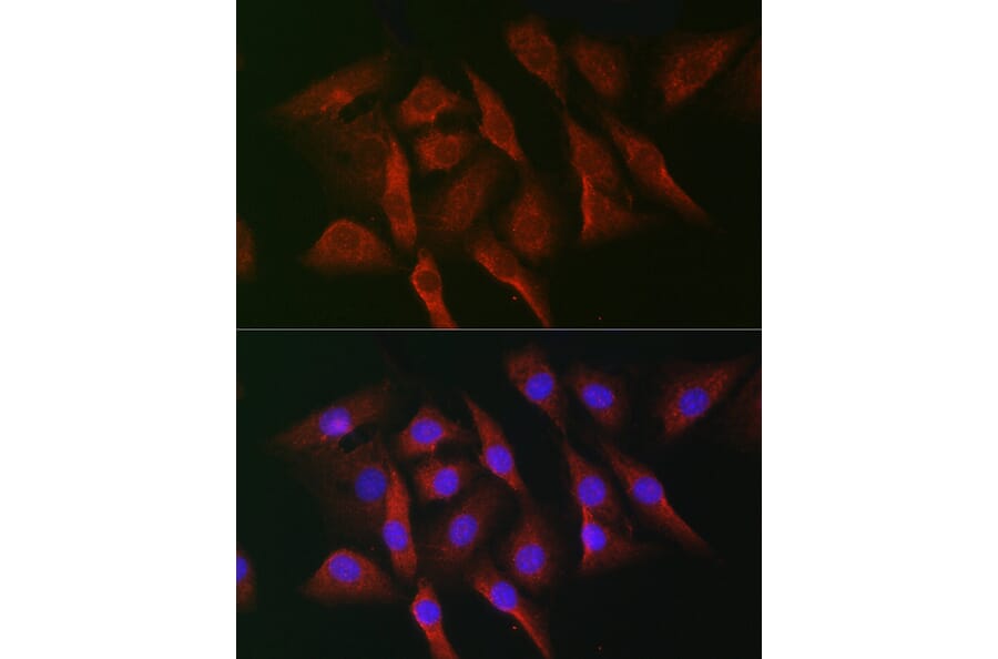 Immunofluorescence - Anti-MNK1 Antibody (A309108) - Antibodies.com