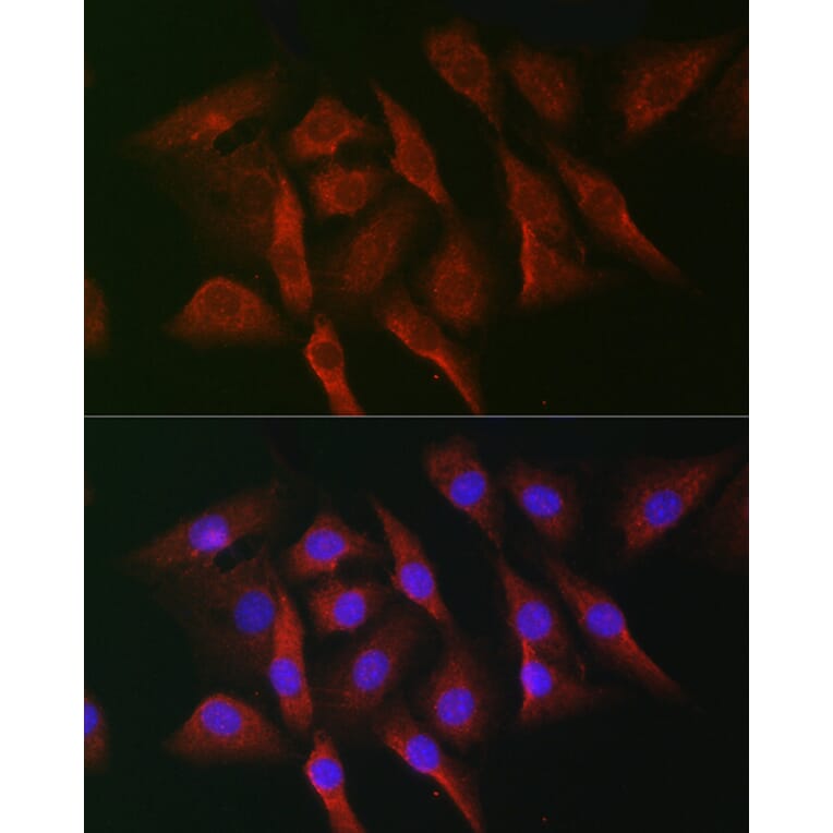 Immunofluorescence - Anti-MNK1 Antibody (A309108) - Antibodies.com