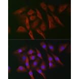 Immunofluorescence - Anti-MNK1 Antibody (A309108) - Antibodies.com