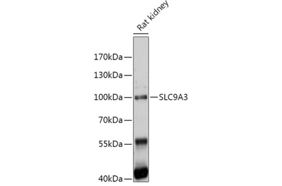 Western Blot - Anti-Sodium/Hydrogen Exchanger 3/NHE-3 Antibody (A309111) - Antibodies.com