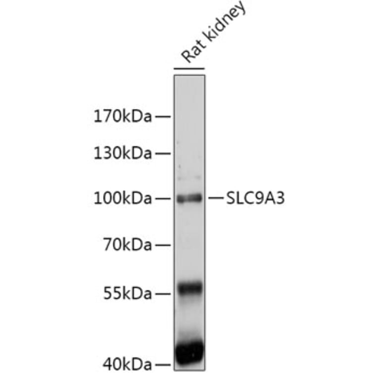 Western Blot - Anti-Sodium/Hydrogen Exchanger 3/NHE-3 Antibody (A309111) - Antibodies.com