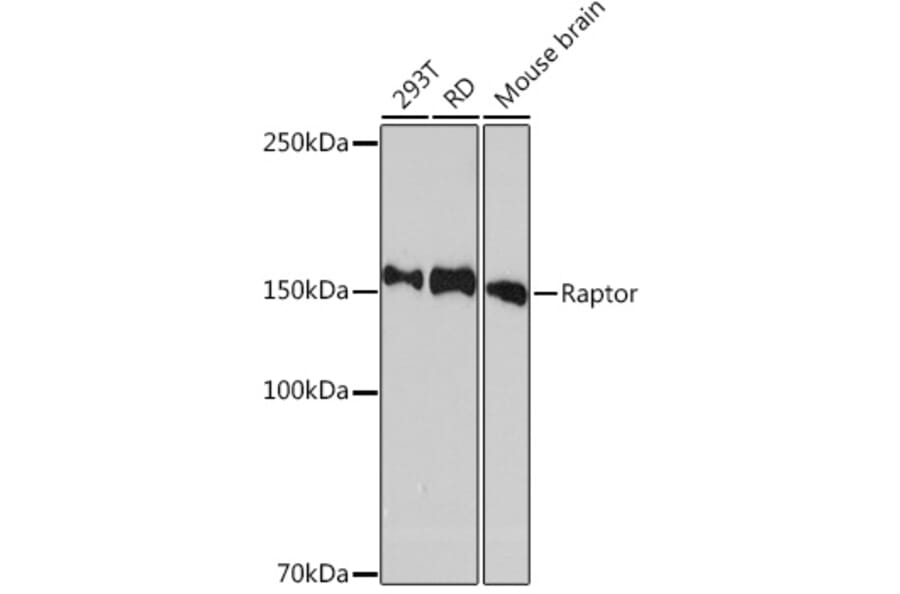 Western Blot - Anti-Raptor Antibody [ARC1375] (A309112) - Antibodies.com