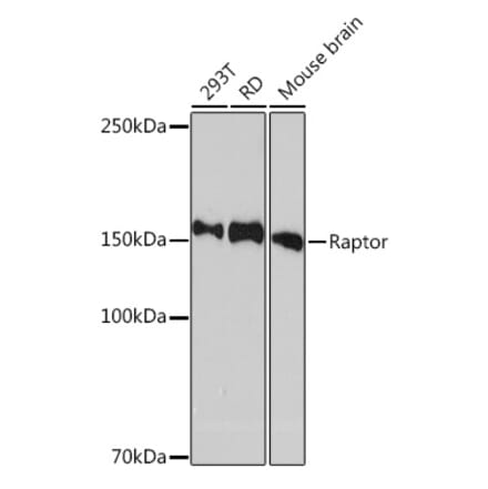Western Blot - Anti-Raptor Antibody [ARC1375] (A309112) - Antibodies.com
