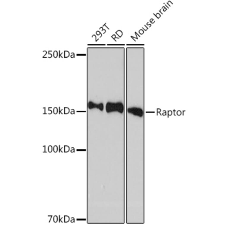 Western Blot - Anti-Raptor Antibody [ARC1375] (A309112) - Antibodies.com