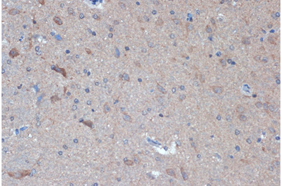 Immunohistochemistry - Anti-Raptor Antibody [ARC1375] (A309112) - Antibodies.com