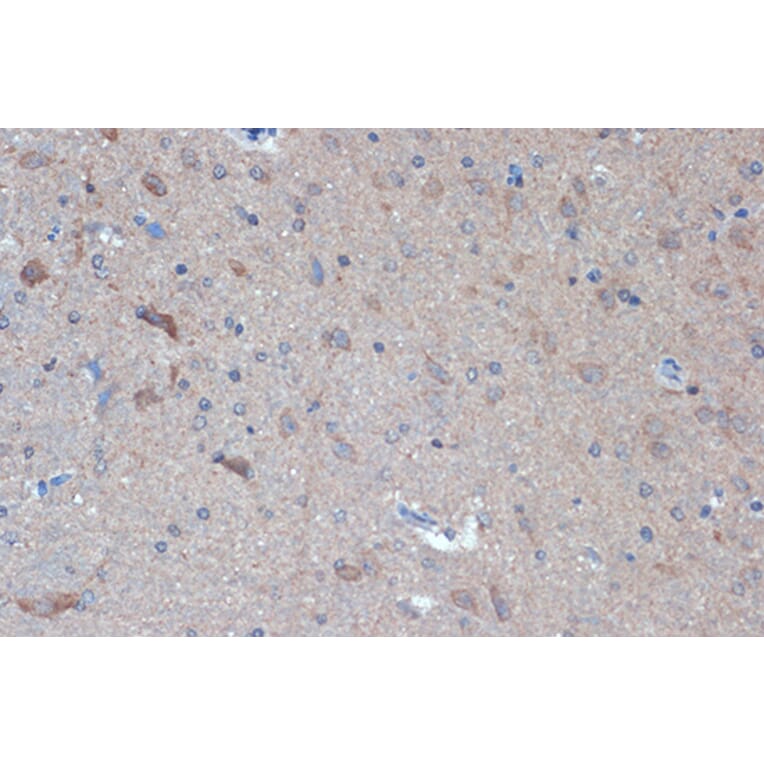 Immunohistochemistry - Anti-Raptor Antibody [ARC1375] (A309112) - Antibodies.com