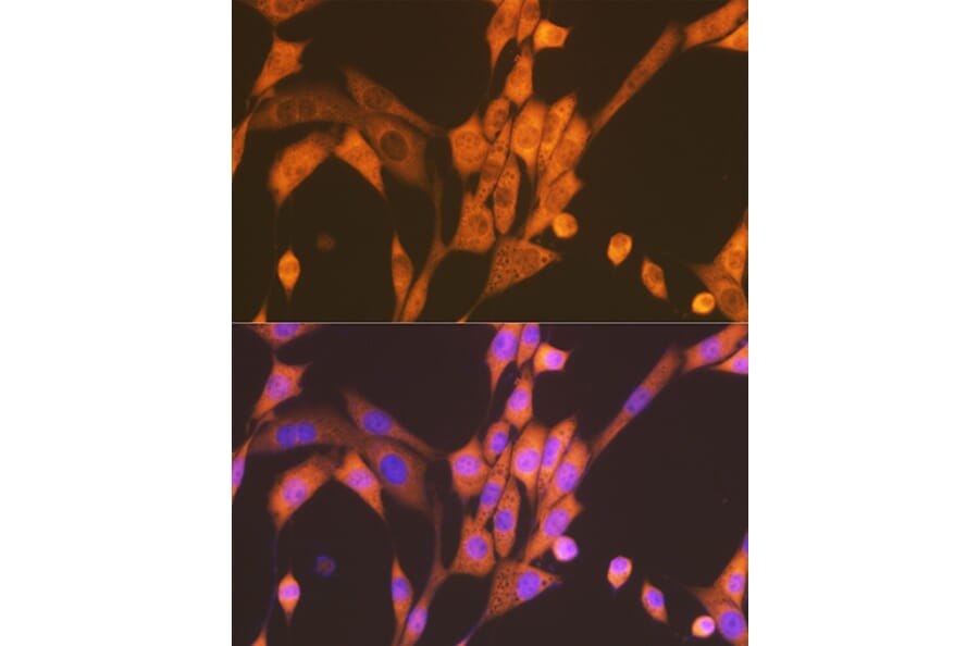 Immunofluorescence - Anti-Raptor Antibody [ARC1375] (A309112) - Antibodies.com