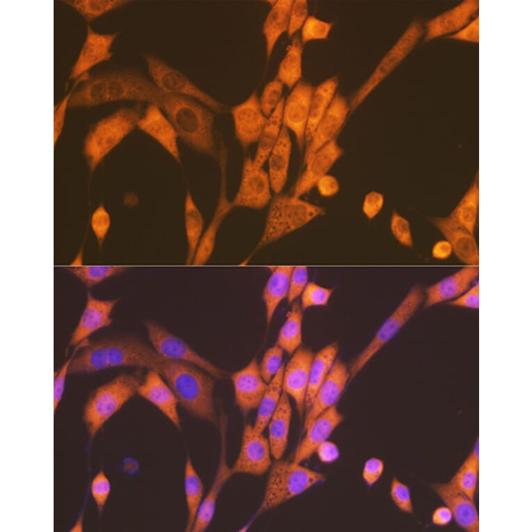 Immunofluorescence - Anti-Raptor Antibody [ARC1375] (A309112) - Antibodies.com