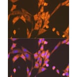 Immunofluorescence - Anti-Raptor Antibody [ARC1375] (A309112) - Antibodies.com