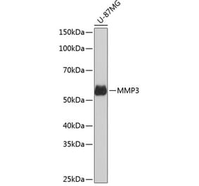 Western Blot - Anti-MMP3 Antibody [ARC51098] (A309113) - Antibodies.com