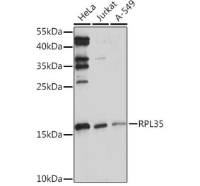 Western Blot - Anti-RPL35 Antibody (A309114) - Antibodies.com