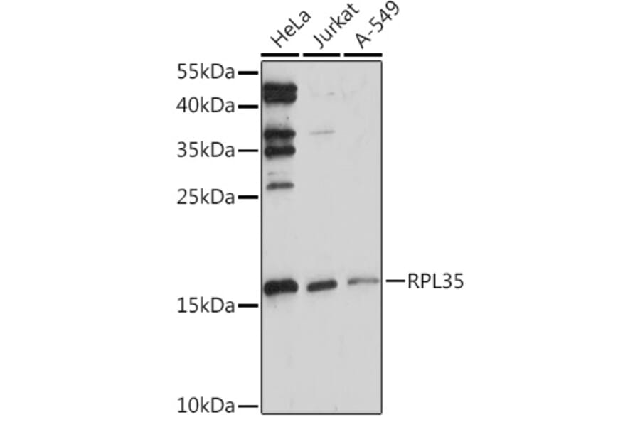 Western Blot - Anti-RPL35 Antibody (A309114) - Antibodies.com