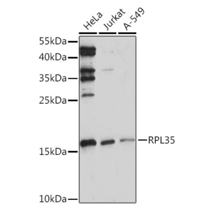 Western Blot - Anti-RPL35 Antibody (A309114) - Antibodies.com