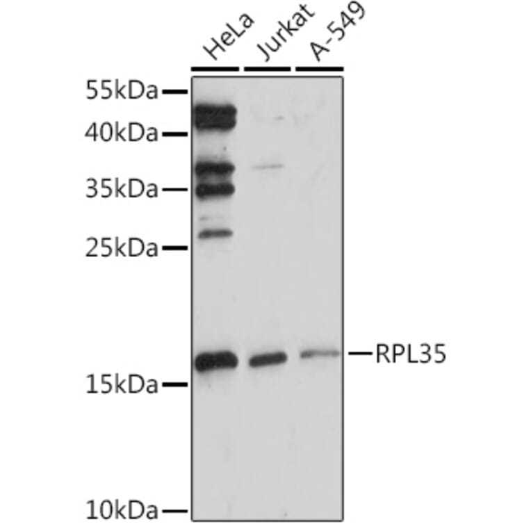 Western Blot - Anti-RPL35 Antibody (A309114) - Antibodies.com