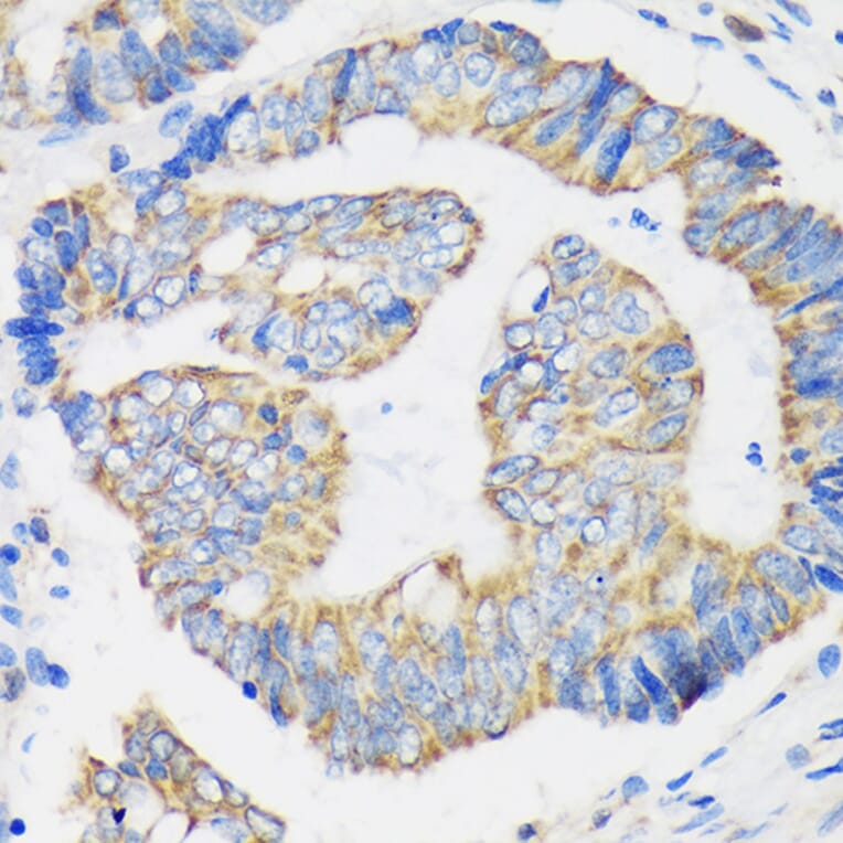 Immunohistochemistry - Anti-RPL35 Antibody (A309114) - Antibodies.com