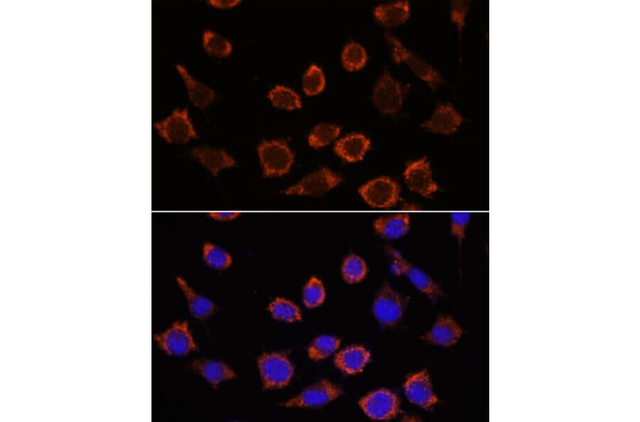 Immunofluorescence - Anti-RPL35 Antibody (A309114) - Antibodies.com