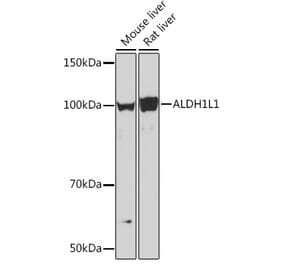 Western Blot - Anti-ALDH1L1 Antibody [ARC1432] (A309115) - Antibodies.com