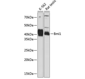 Western Blot - Anti-Bmi1 Antibody [ARC0376] (A309116) - Antibodies.com