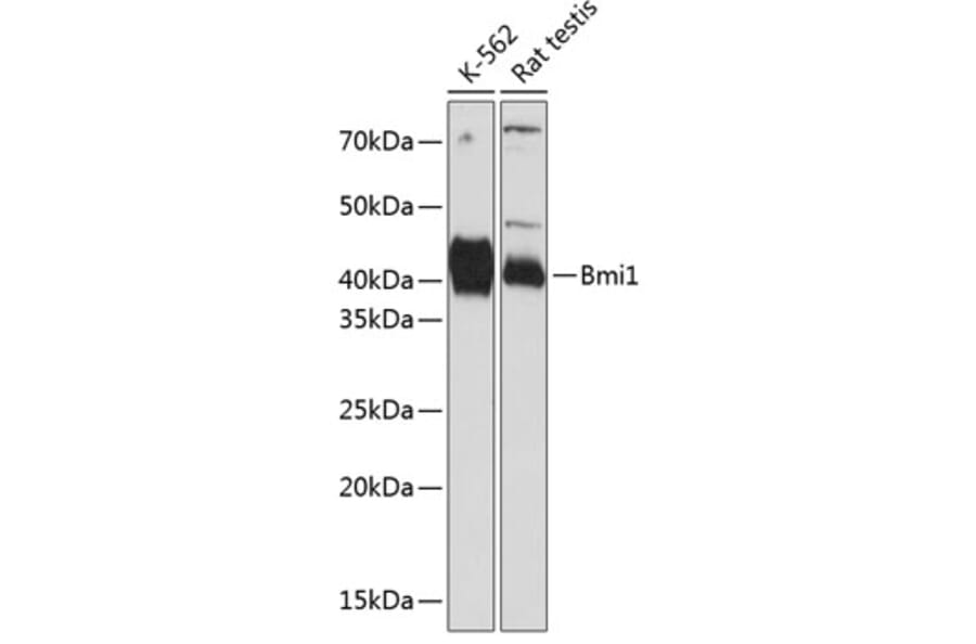 Western Blot - Anti-Bmi1 Antibody [ARC0376] (A309116) - Antibodies.com