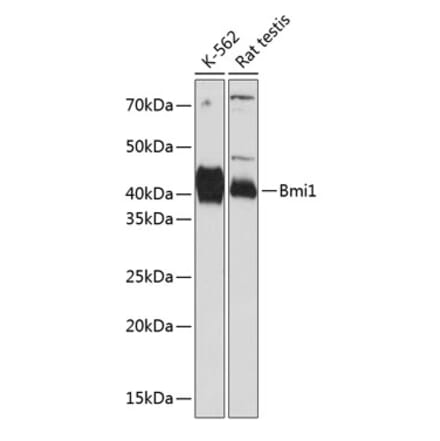 Western Blot - Anti-Bmi1 Antibody [ARC0376] (A309116) - Antibodies.com