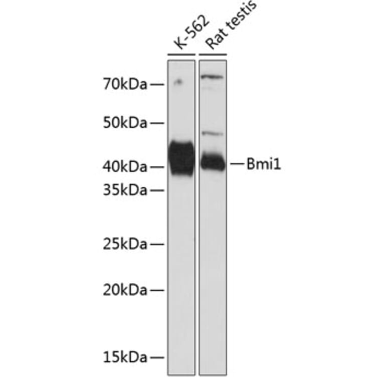 Western Blot - Anti-Bmi1 Antibody [ARC0376] (A309116) - Antibodies.com