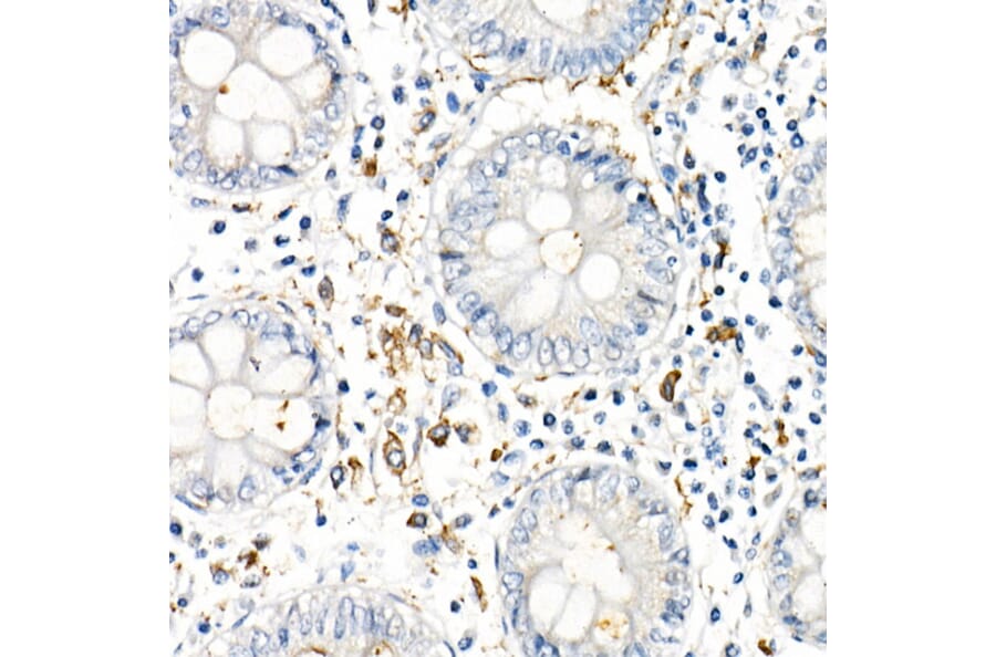 Immunohistochemistry - Anti-TNF alpha Antibody (A309118) - Antibodies.com