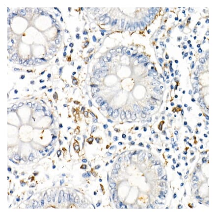 Immunohistochemistry - Anti-TNF alpha Antibody [ARC52538] (A309118) - Antibodies.com