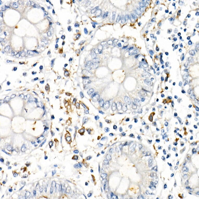 Immunohistochemistry - Anti-TNF alpha Antibody (A309118) - Antibodies.com