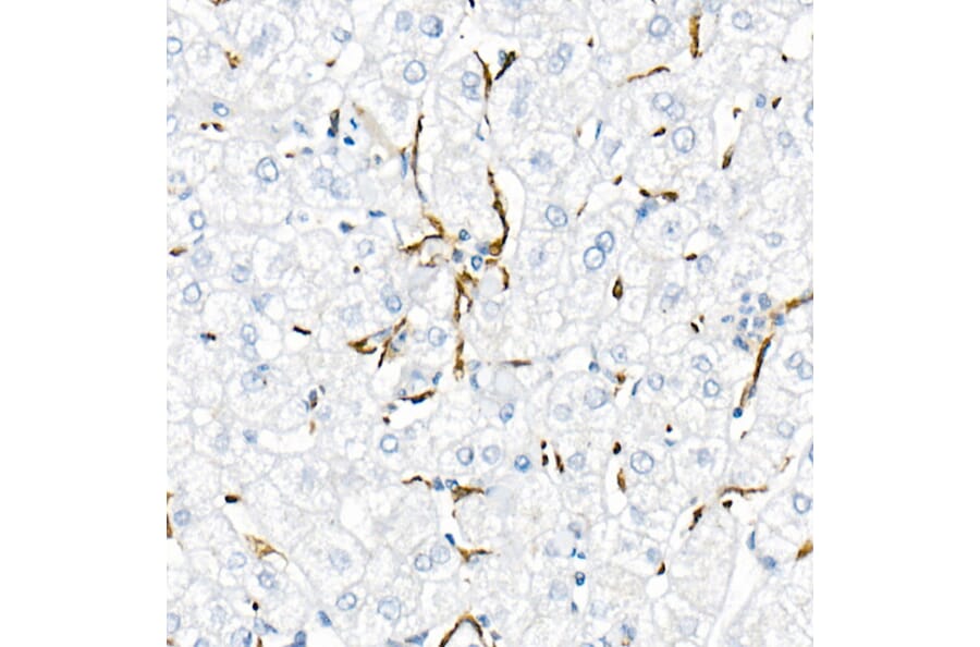 Immunohistochemistry - Anti-TNF alpha Antibody (A309118) - Antibodies.com