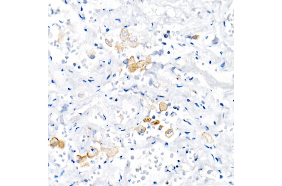 Immunohistochemistry - Anti-TNF alpha Antibody (A309118) - Antibodies.com