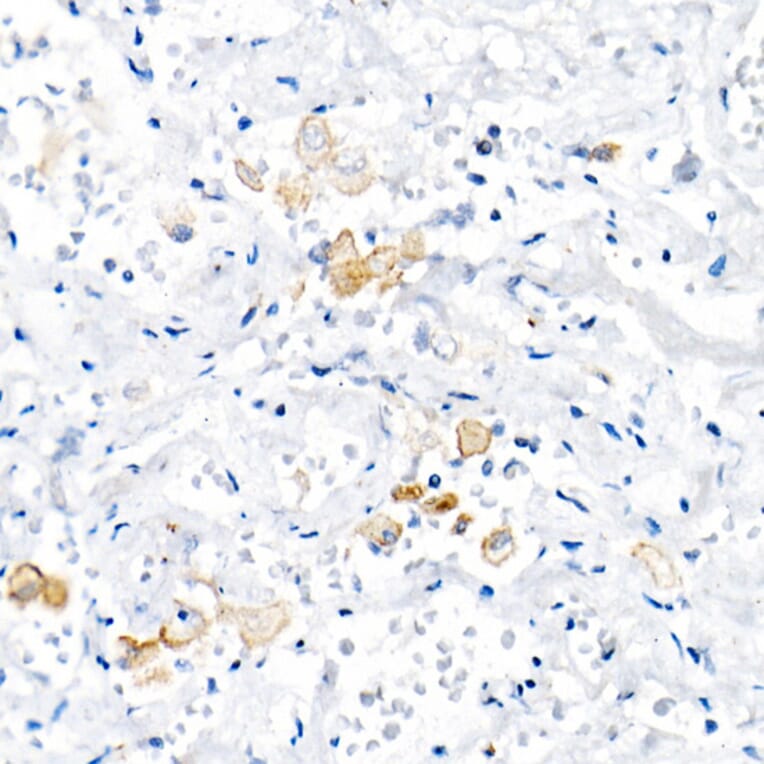 Immunohistochemistry - Anti-TNF alpha Antibody (A309118) - Antibodies.com