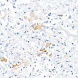 Immunohistochemistry - Anti-TNF alpha Antibody (A309118) - Antibodies.com