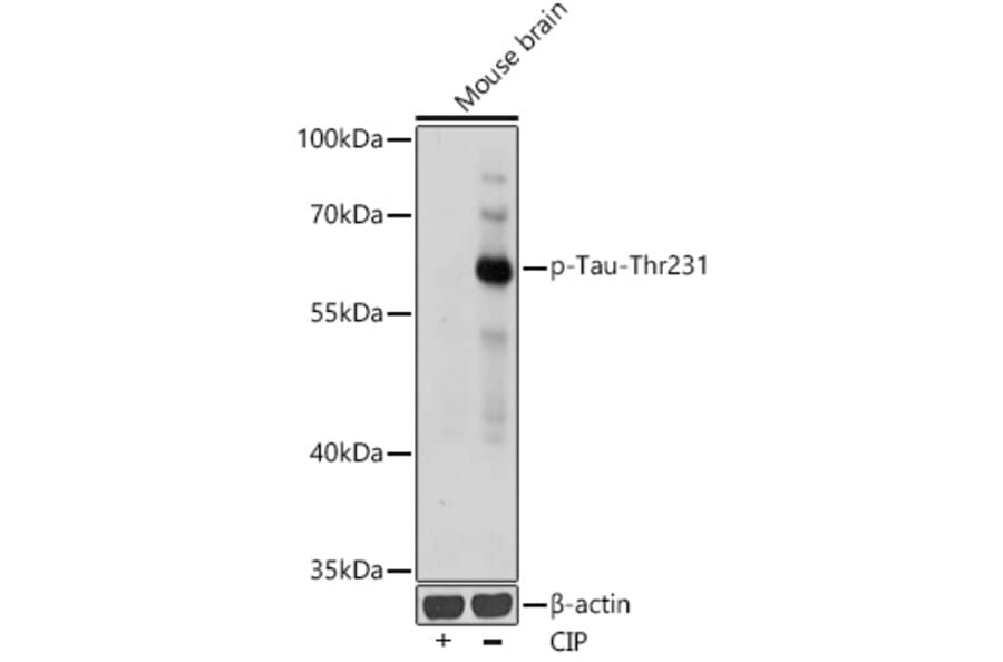 Western Blot - Anti-Tau (phospho Thr231) Antibody (A309119) - Antibodies.com