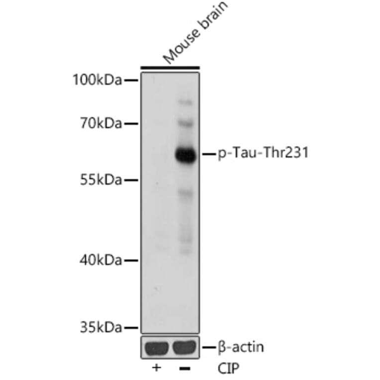 Western Blot - Anti-Tau (phospho Thr231) Antibody (A309119) - Antibodies.com