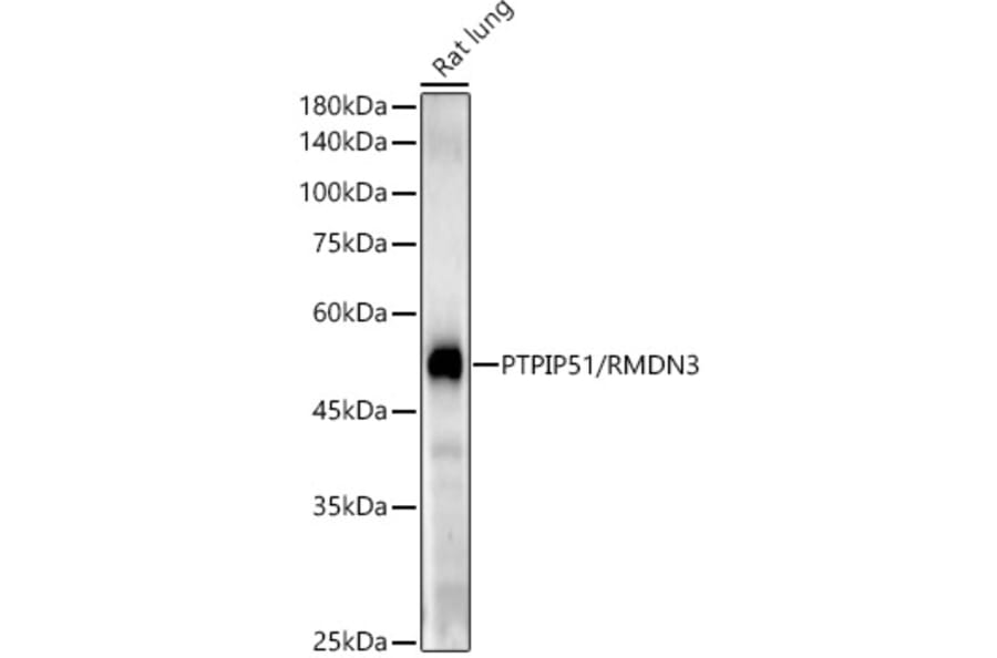 Western Blot - Anti-PTPIP51 Antibody [ARC54933] (A309120) - Antibodies.com