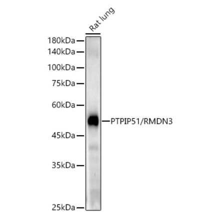 Western Blot - Anti-PTPIP51 Antibody [ARC54933] (A309120) - Antibodies.com