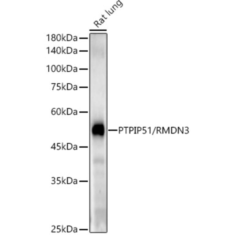 Western Blot - Anti-PTPIP51 Antibody [ARC54933] (A309120) - Antibodies.com