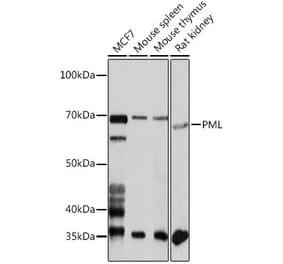 Western Blot - Anti-PML Protein Antibody (A309121) - Antibodies.com