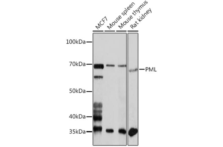 Western Blot - Anti-PML Protein Antibody (A309121) - Antibodies.com