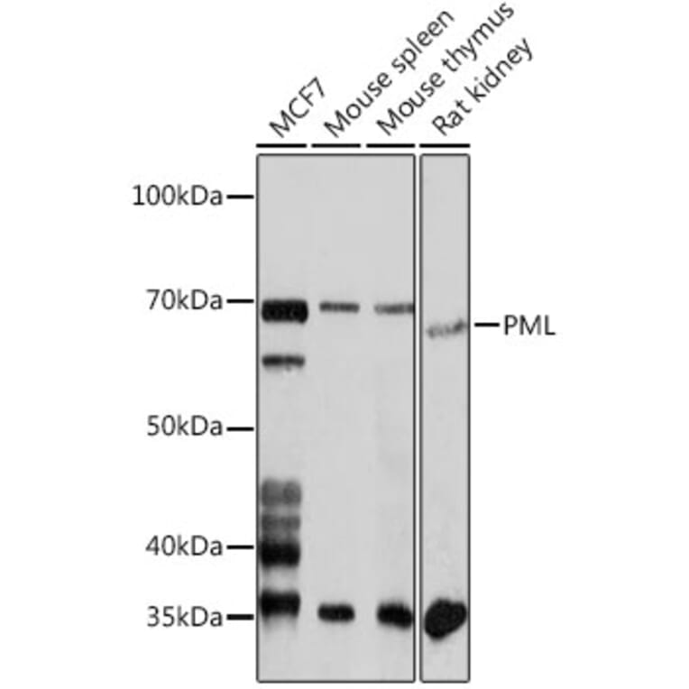 Western Blot - Anti-PML Protein Antibody (A309121) - Antibodies.com