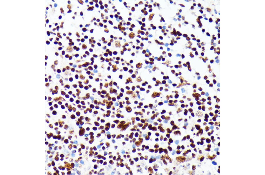 Immunohistochemistry - Anti-PML Protein Antibody (A309121) - Antibodies.com