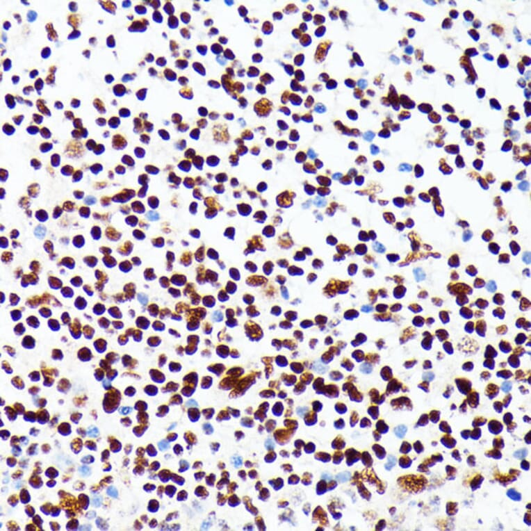 Immunohistochemistry - Anti-PML Protein Antibody (A309121) - Antibodies.com