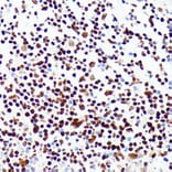 Immunohistochemistry - Anti-PML Protein Antibody (A309121) - Antibodies.com