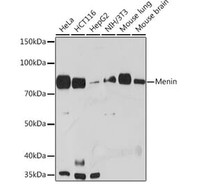 Western Blot - Anti-Menin Antibody [ARC1968] (A309122) - Antibodies.com
