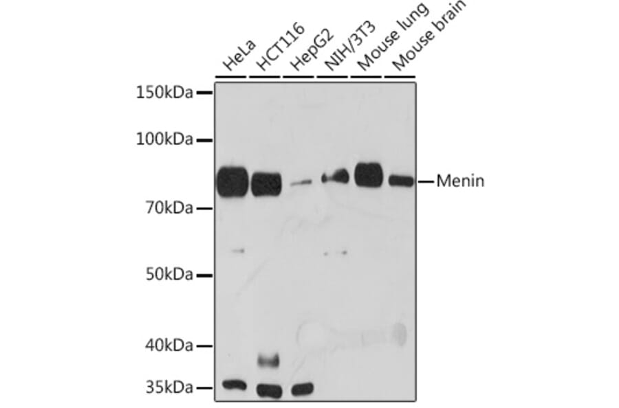Western Blot - Anti-Menin Antibody [ARC1968] (A309122) - Antibodies.com