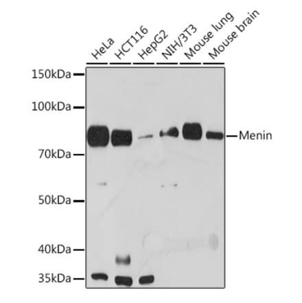 Western Blot - Anti-Menin Antibody [ARC1968] (A309122) - Antibodies.com