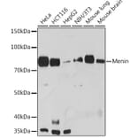 Western Blot - Anti-Menin Antibody [ARC1968] (A309122) - Antibodies.com