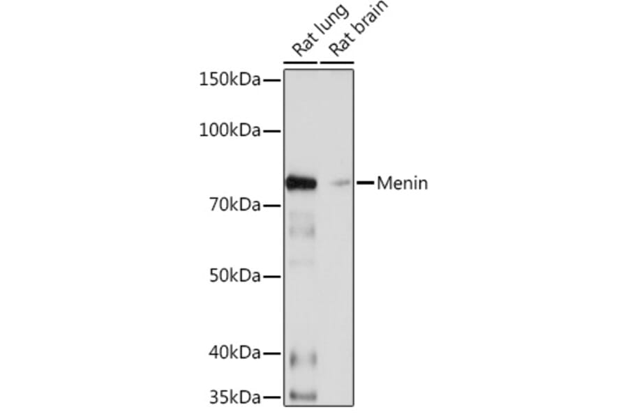 Western Blot - Anti-Menin Antibody [ARC1968] (A309122) - Antibodies.com